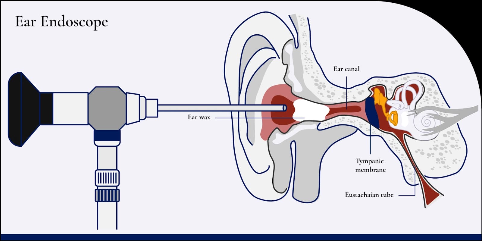 Ear endoscope