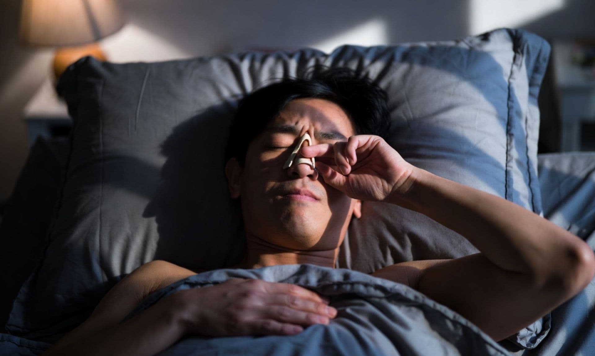 Deviated nasal septum