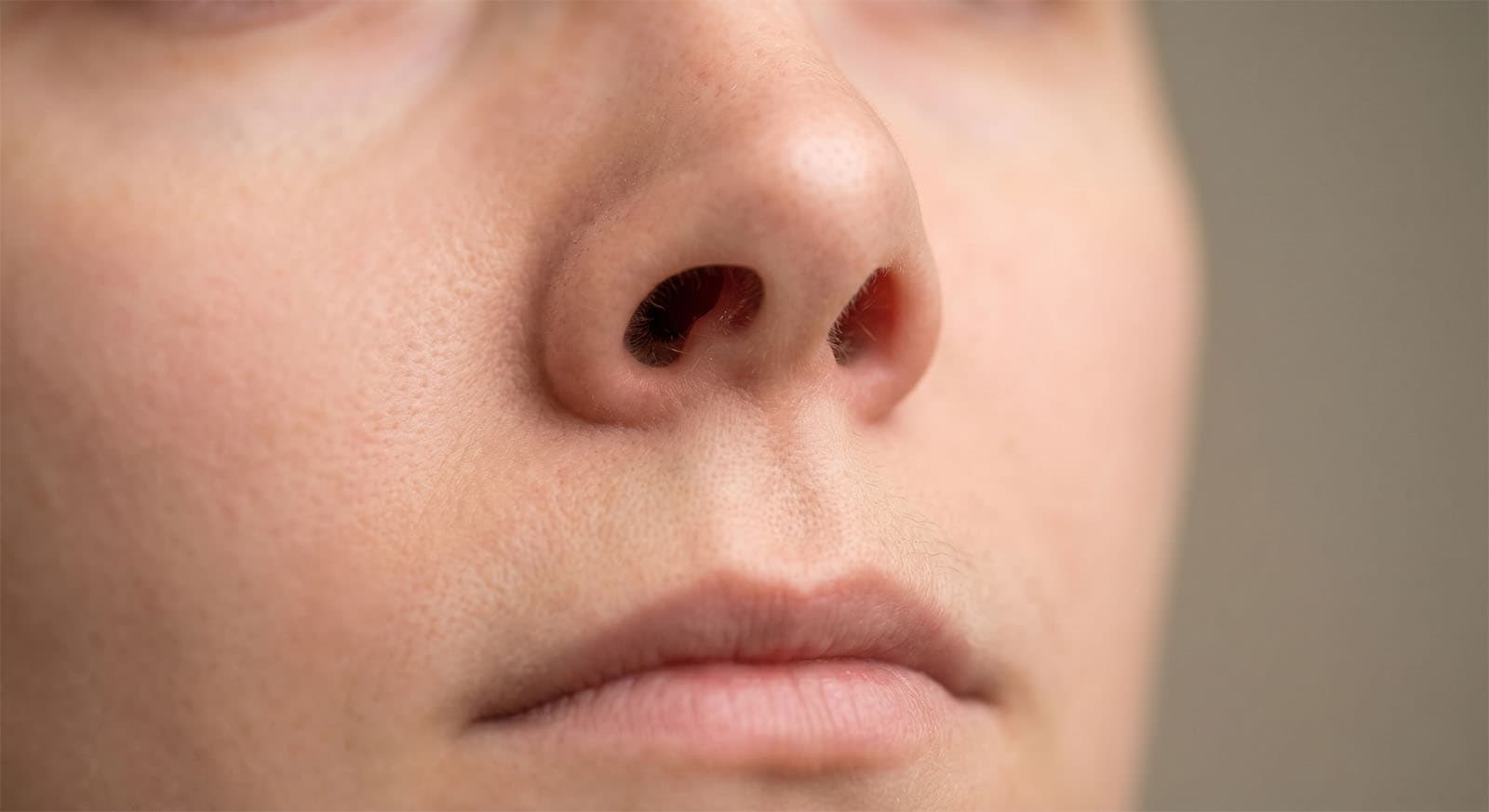 Deviated nasal septum diagram